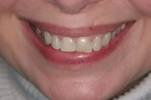 before dentistry at Flax Dental