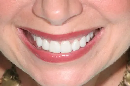 after dentistry at Flax Dental