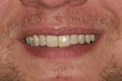 before dentistry at Flax Dental