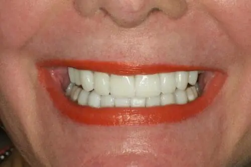 after dentistry at Flax Dental