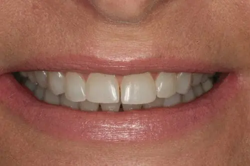 before dentistry at Flax Dental