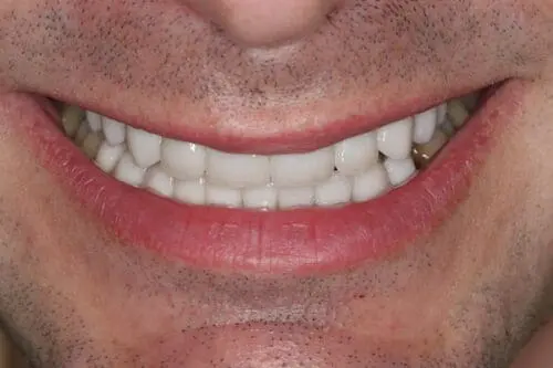 after dentistry at Flax Dental