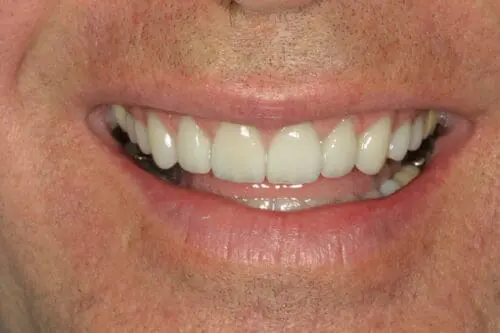 after dentistry at Flax Dental