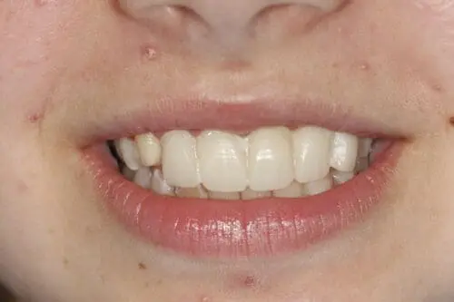 before dentistry at Flax Dental