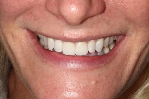 after dentistry at Flax Dental