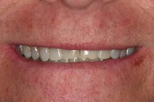 before dentistry at Flax Dental