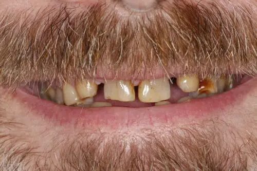 before dentistry at Flax Dental