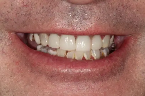 before dentistry at Flax Dental