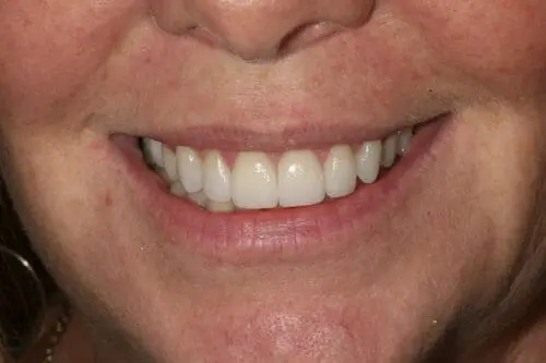after dentistry at Flax Dental