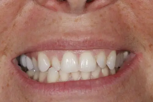 before dentistry at Flax Dental