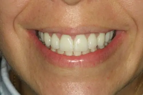 after dentistry at Flax Dental
