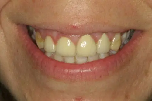 before dentistry at Flax Dental