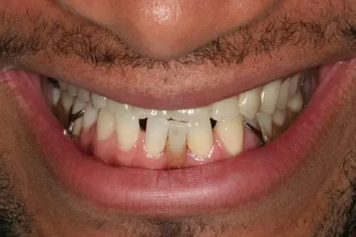 before dentistry at Flax Dental