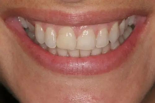 before dentistry at Flax Dental