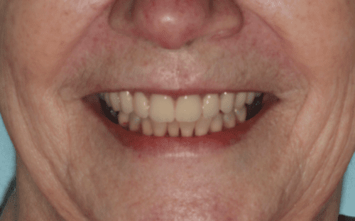 after dentistry at Flax Dental