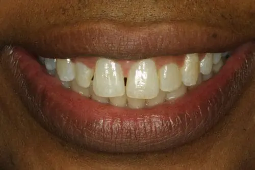 before dentistry at Flax Dental