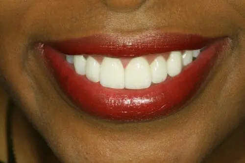 after dentistry at Flax Dental