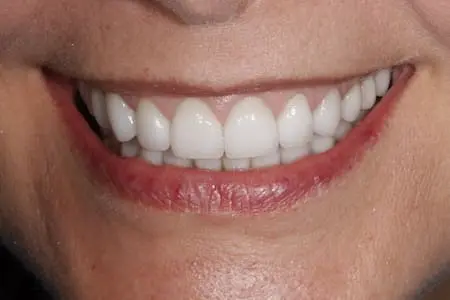 after dentistry at Flax Dental