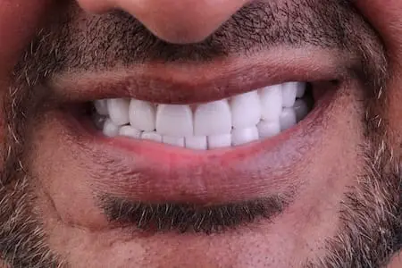 after dentistry at Flax Dental