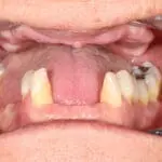Before cosmetic dentistry