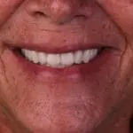 cosmetic dentistry results